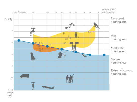 Audiogram showing the mild and moderate hearing-loss bands where Cearvol devices are indicated